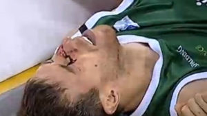Fran Vazquez si è rotto il naso in uno scontro fortuito con Tavares.